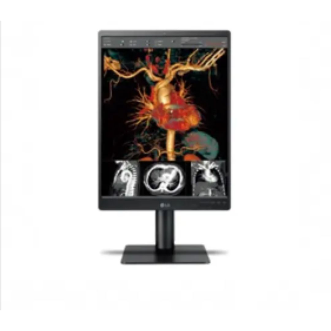 Lg Color Diagnostic Display: Enhance Your Medical Imaging